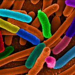 diverse e coli