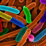 diverse e coli