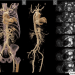 avances de medicina forense